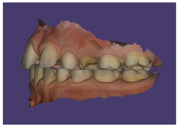 Figure 16