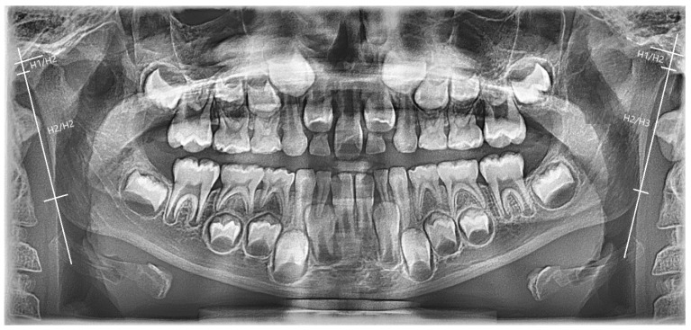 Figure 18