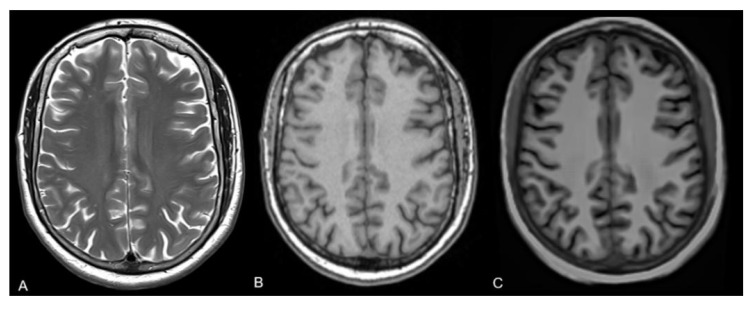 Figure 2