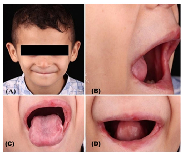 Figure 4