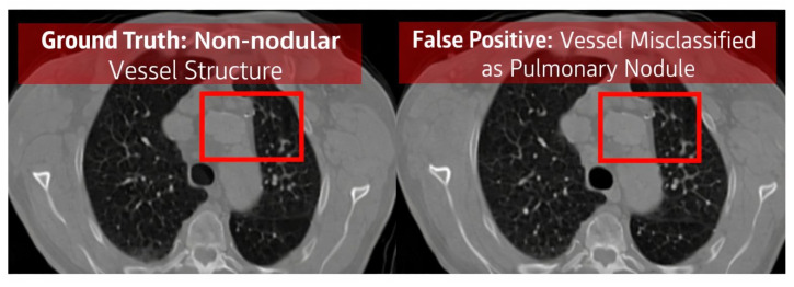 Figure 24