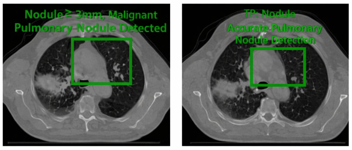 Figure 26