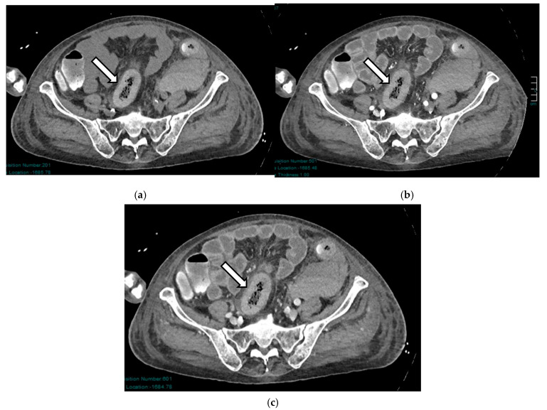 Figure 10