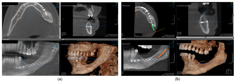 Figure 10