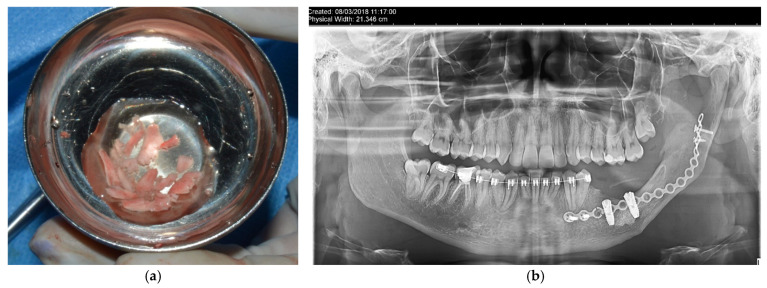 Figure 11
