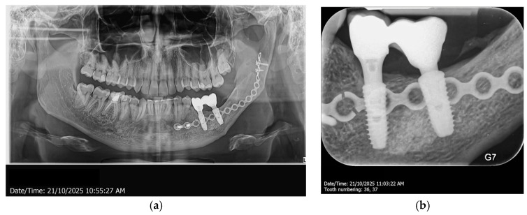 Figure 13