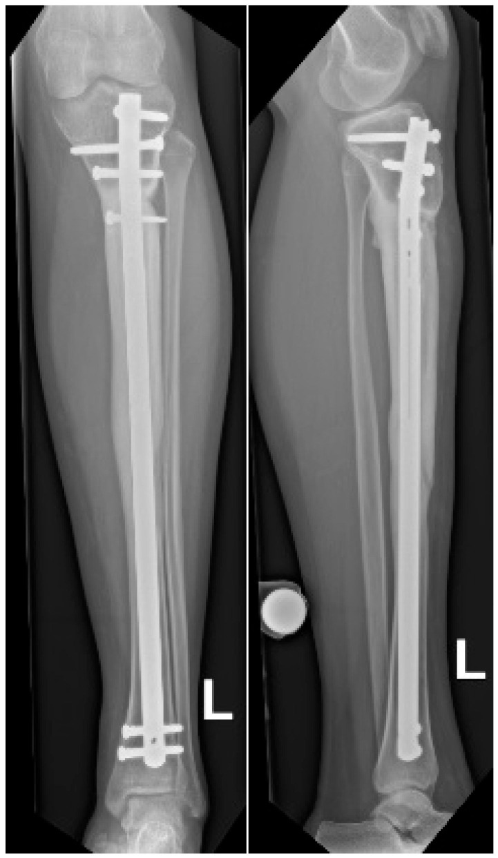 Figure 7