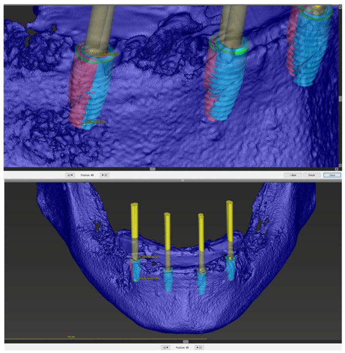 Figure 6