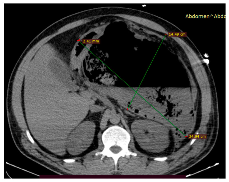 Figure 6