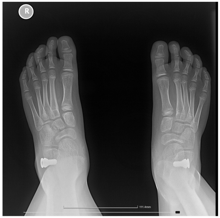 Figure 10