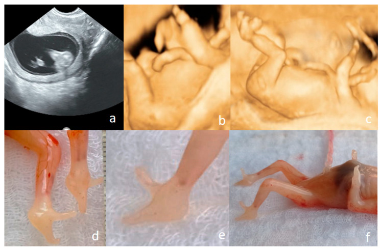 Figure 11