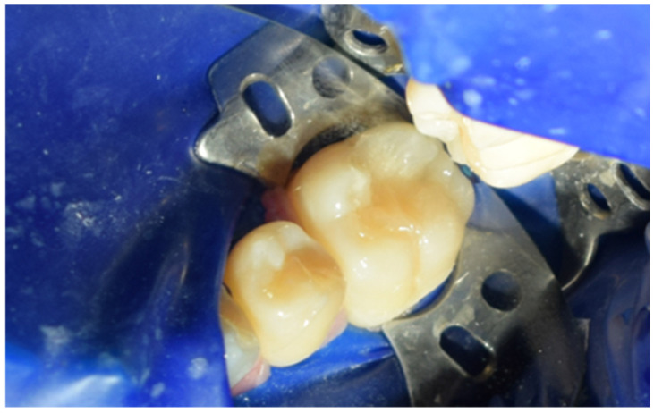 Figure 16