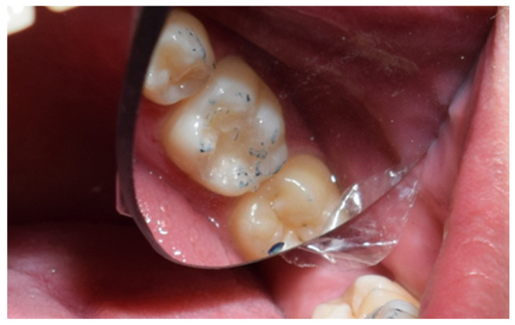 Figure 17