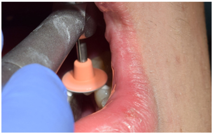 Figure 18