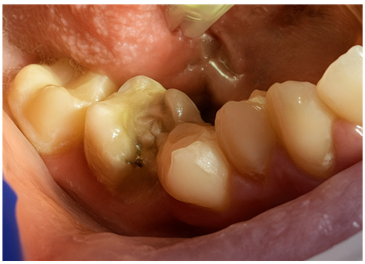Figure 19