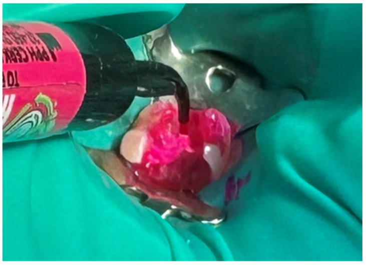 Figure 22