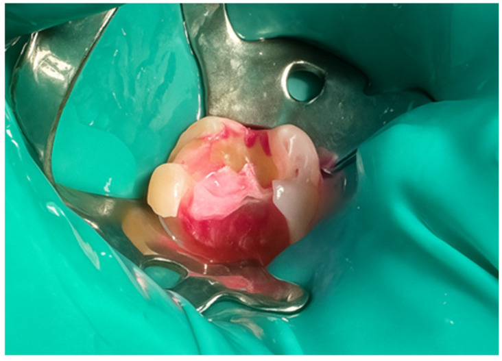 Figure 23