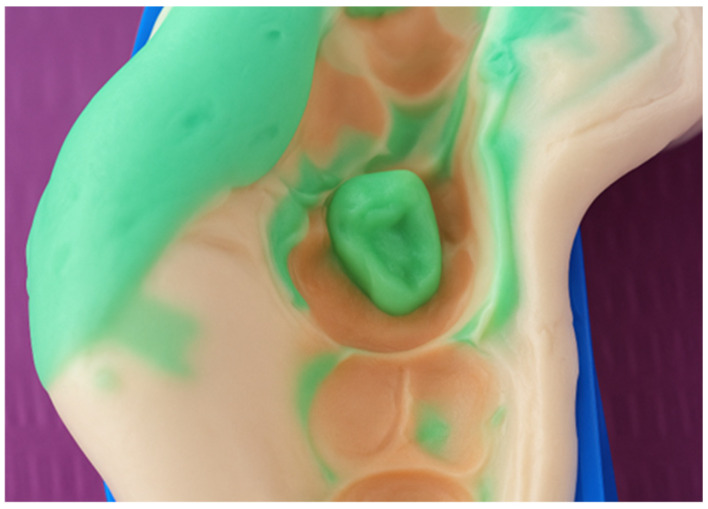 Figure 26