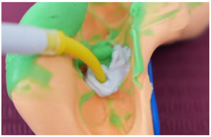 Figure 27