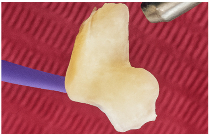 Figure 28