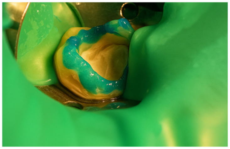Figure 29