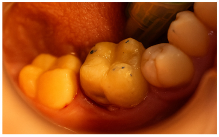 Figure 34