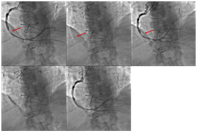 Figure 5
