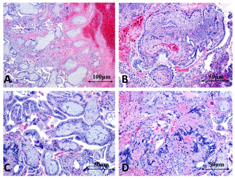 Figure 15