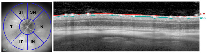 Figure 11
