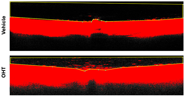 Figure 12