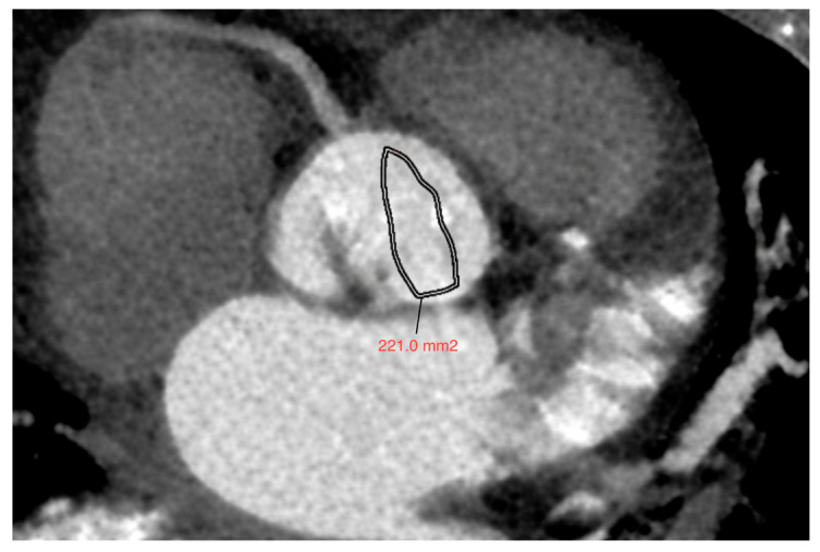 Figure 9