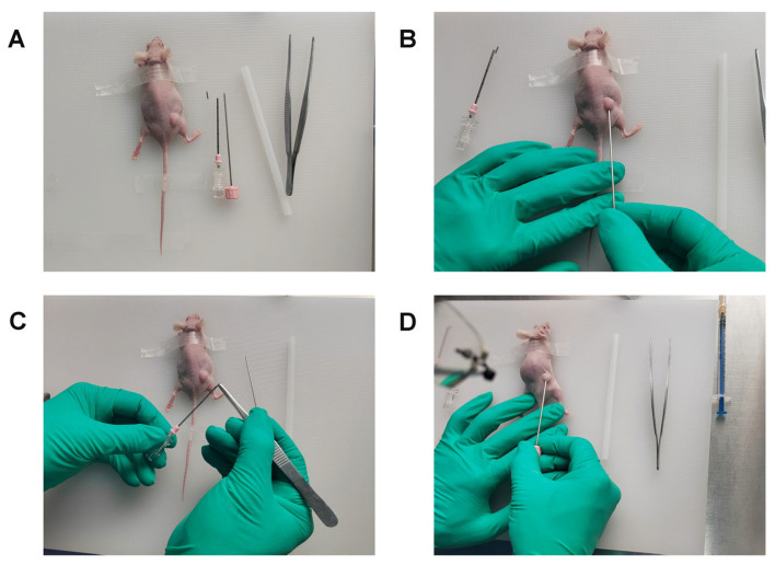 Figure 11