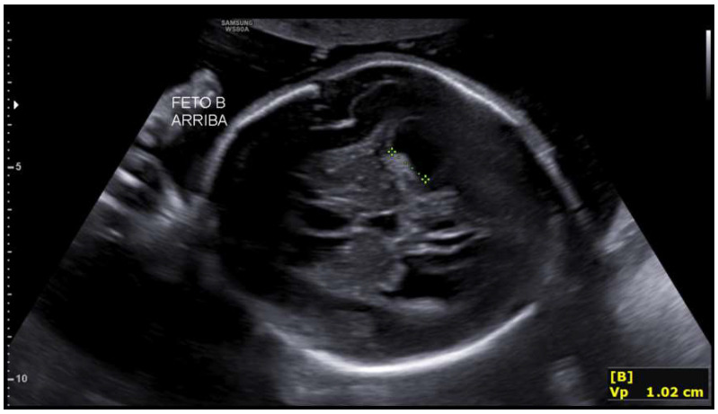 Figure 6