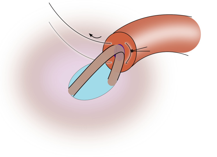 Figure 7