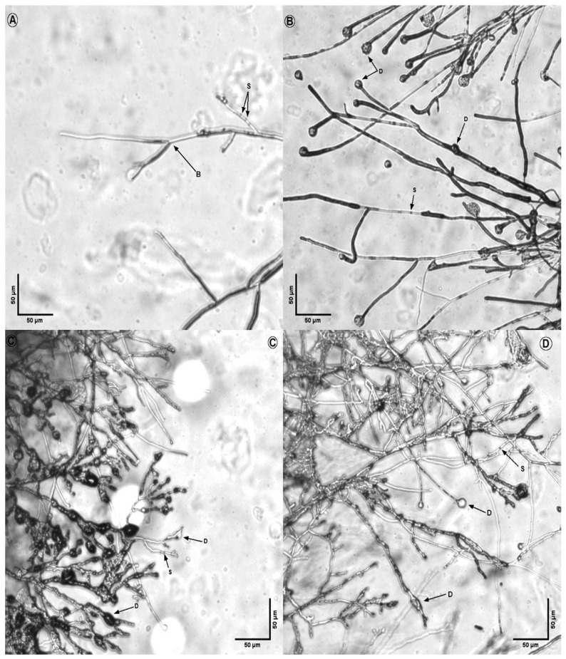 Figure 11