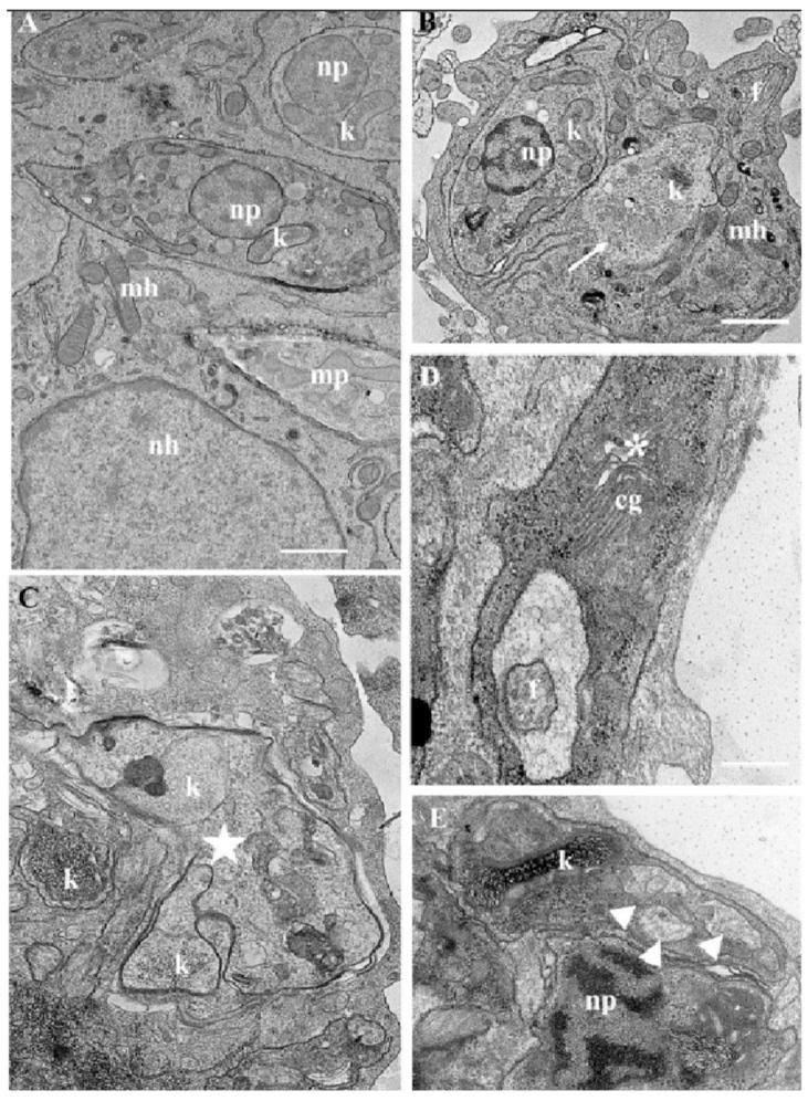 Figure 11