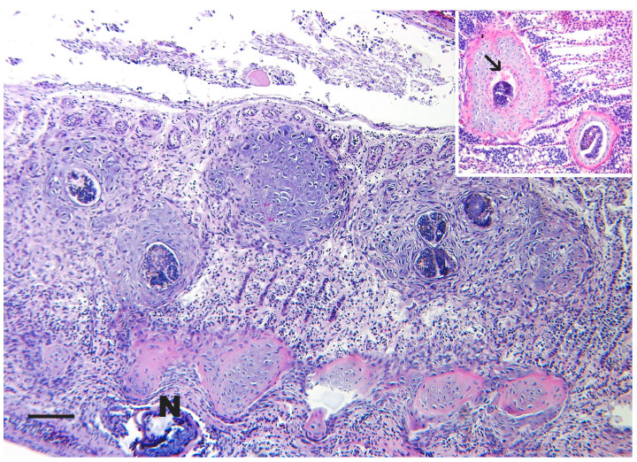 Figure 11