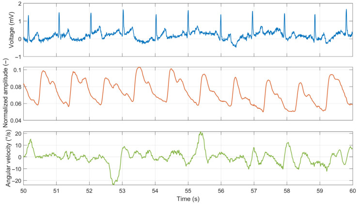 Figure 17