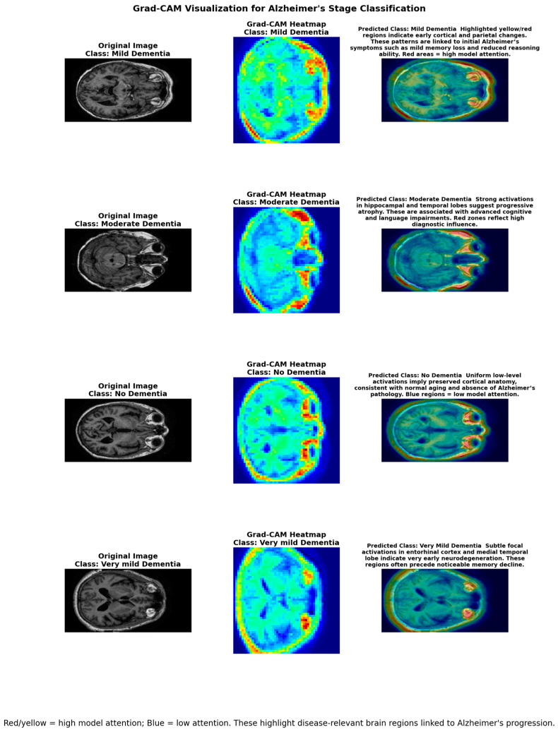 Figure 13
