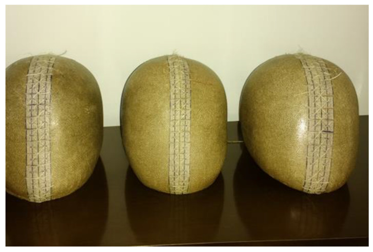 Figure 14