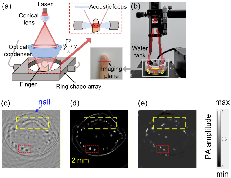 Figure 11