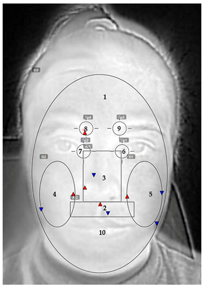 Figure 14