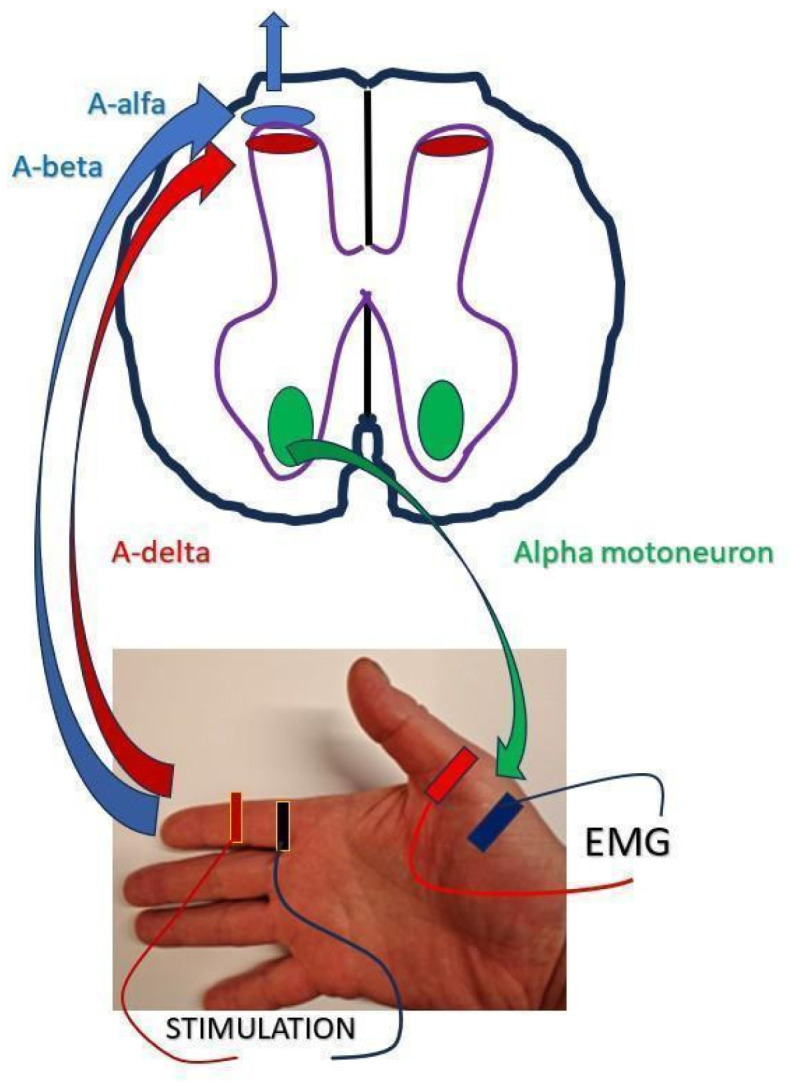 Figure 2