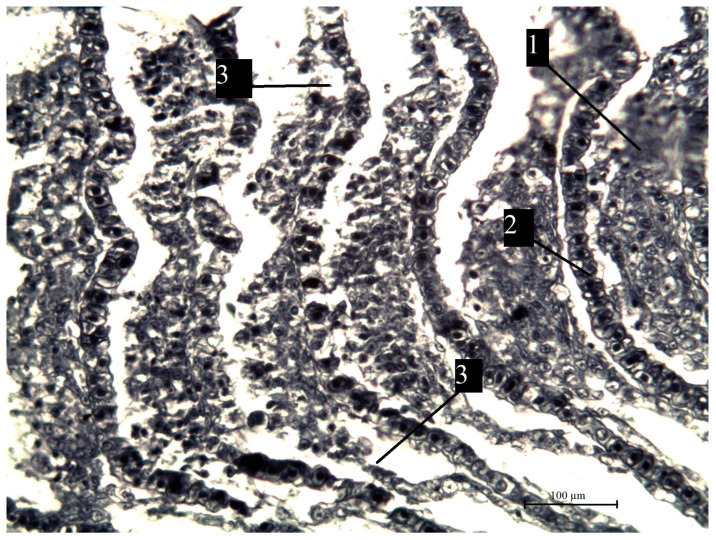 Figure 11