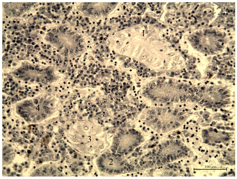 Figure 12