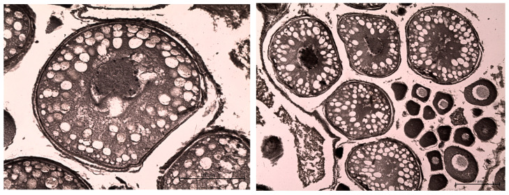 Figure 14