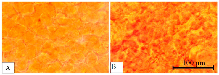 Figure 17