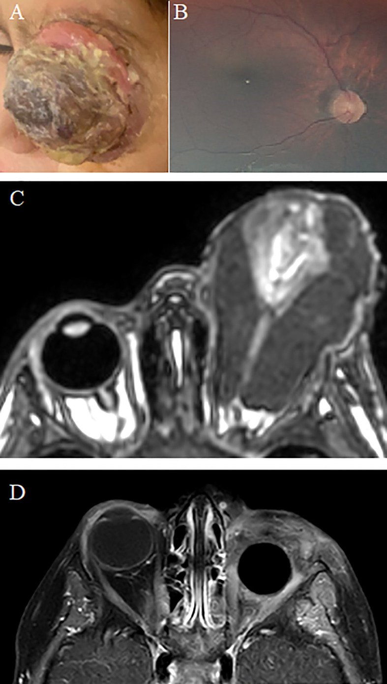 Figure 2