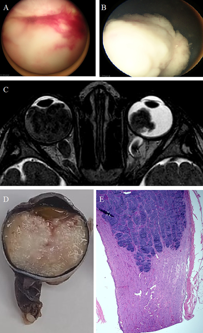 Figure 3