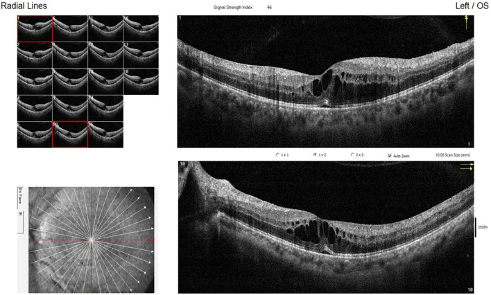 Figure 3